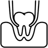 Ícone do serviço Exodontia ( extração dentária)